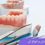 پروتز دندان و انواع آن