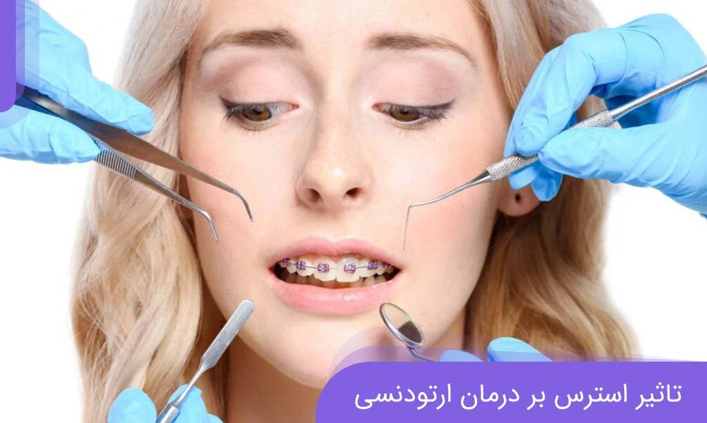 تاثیر استرس بر درمان ارتودنسی