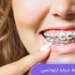 باور های غلط درباره ارتودنسی
