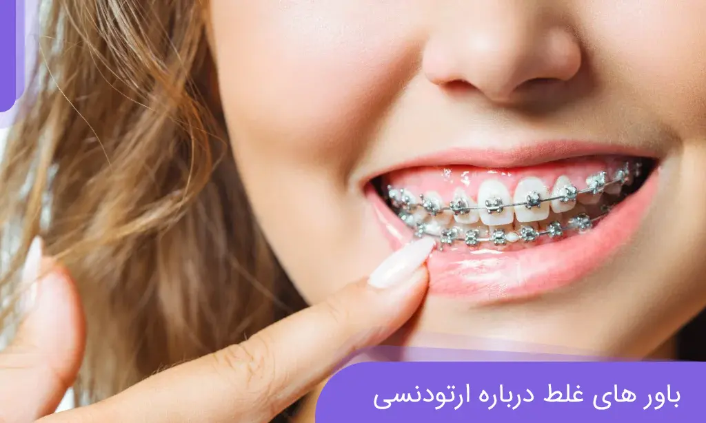 باور های غلط درباره ارتودنسی