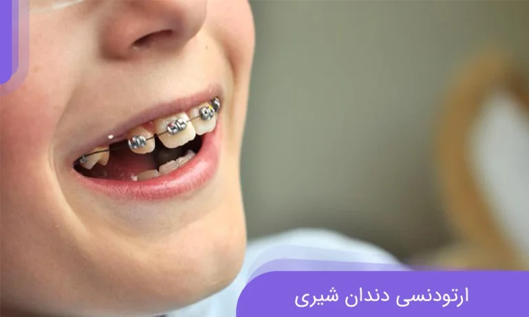 ارتودنسی دندان شیری