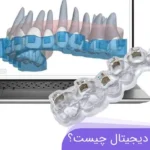 ارتودنسی دیجیتال چیست؟