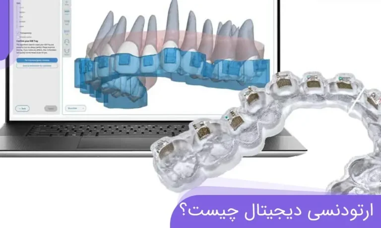 ارتودنسی دیجیتال چیست؟