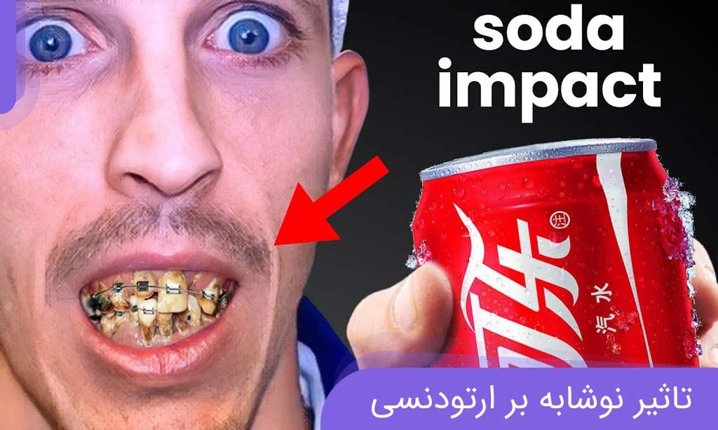 تاثیر نوشابه بر ارتودنسی