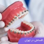 ارتودنسی اقساطی در تهران