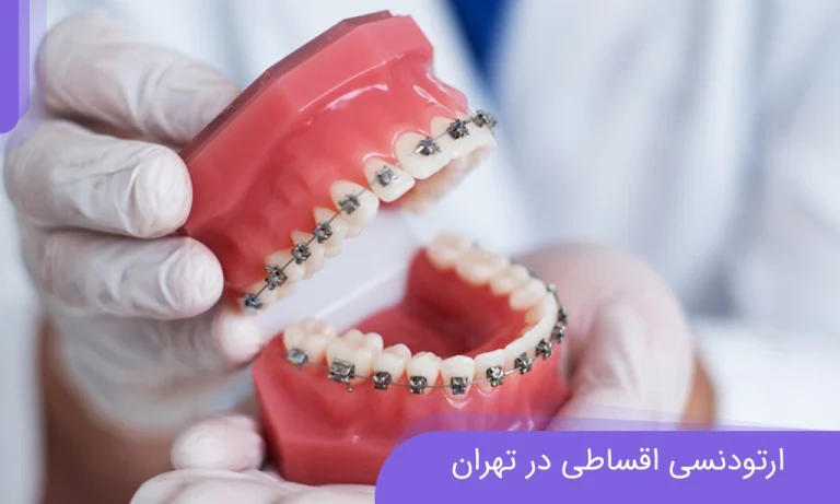 ارتودنسی اقساطی در تهران