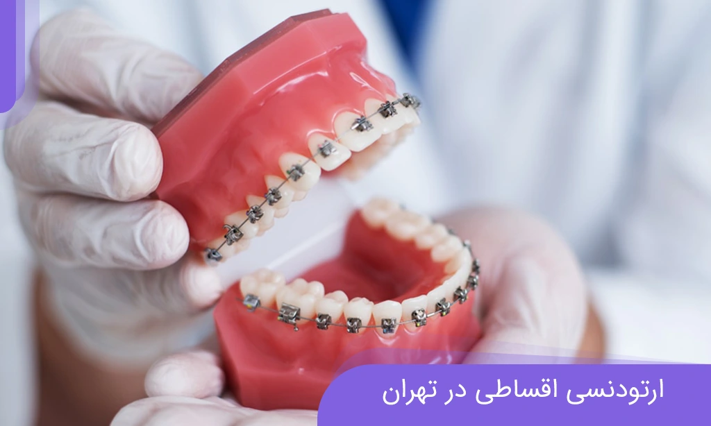 ارتودنسی اقساطی در تهران
