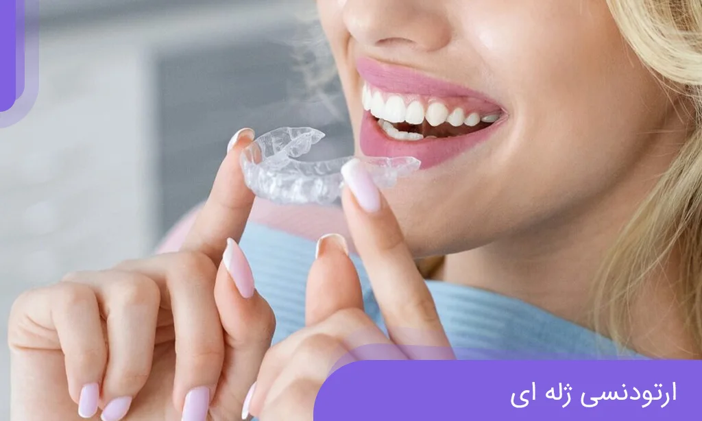 ارتودنسی ژله ای