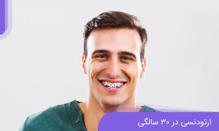 ارتودنسی در 30 سالگی