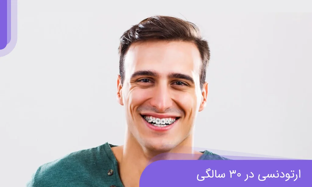 ارتودنسی در 30 سالگی
