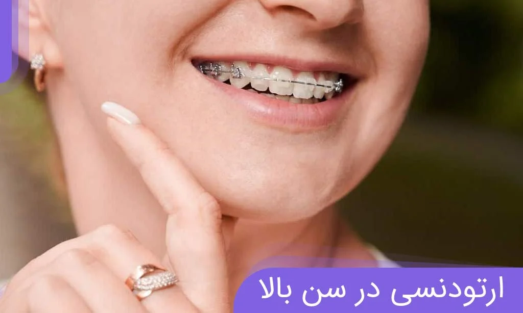 ارتودنسی در سن بالا