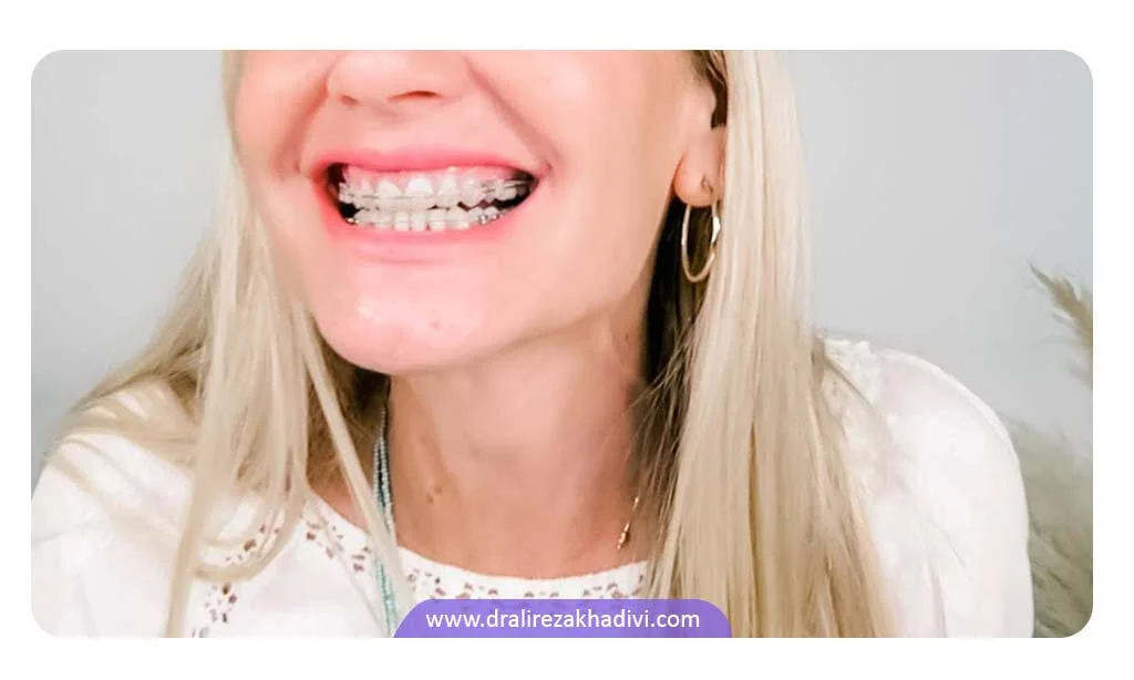 ارتودنسی نامرئی در سن بالا